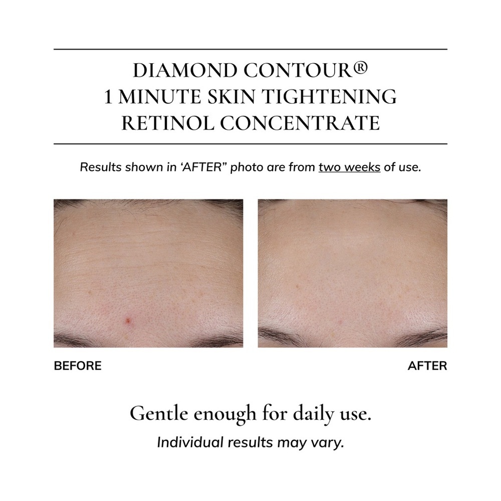 🎀 Kaplan MD Diamond Contour Retinol Concentrate 50ml ✨ Brand New In Box 🎀 - Picture 5 of 10